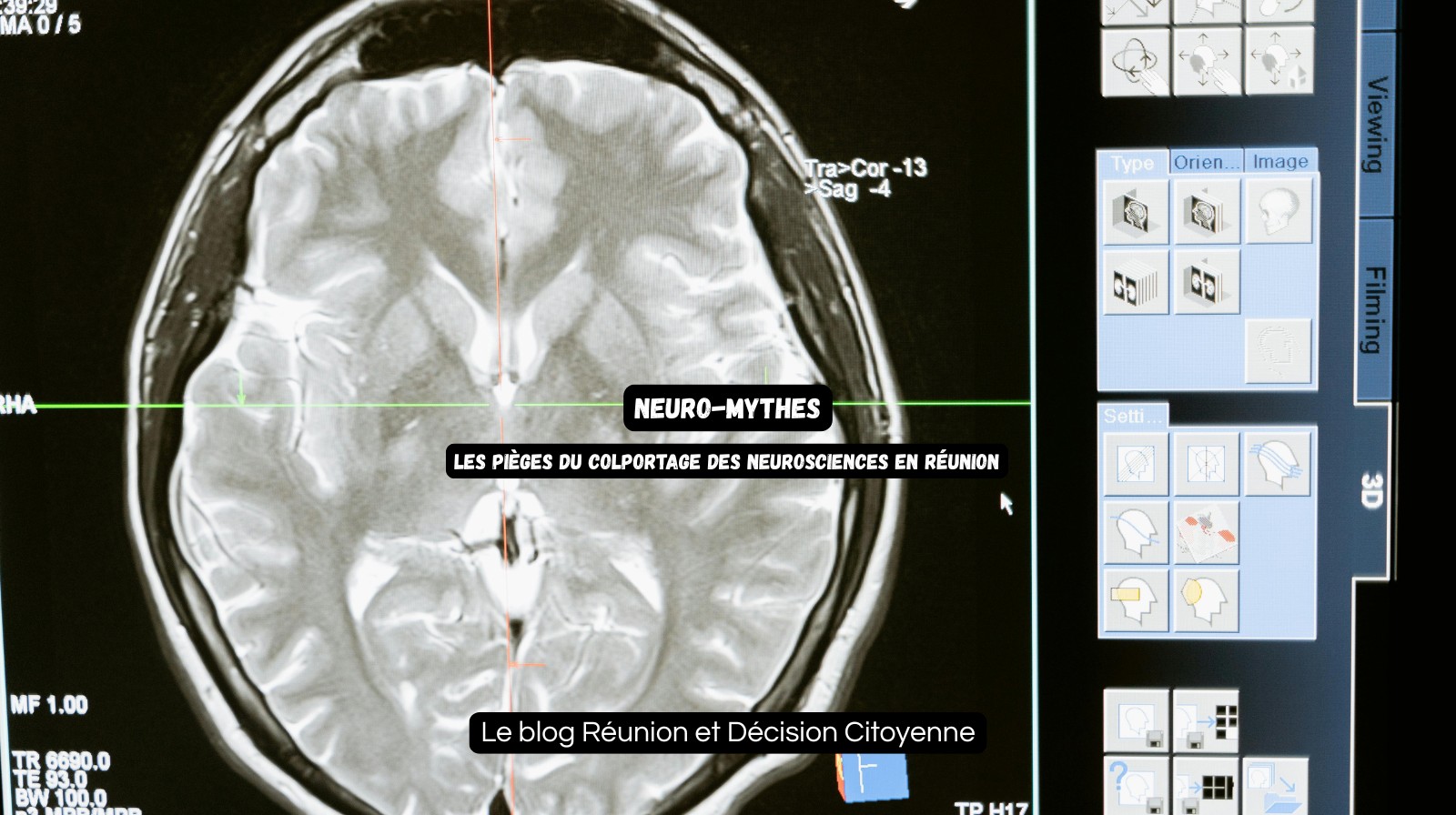 Neuromythes